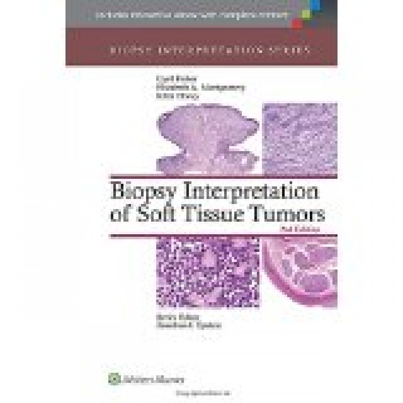 Biopsy Interpretation of Soft Tissue Tumors, 2e