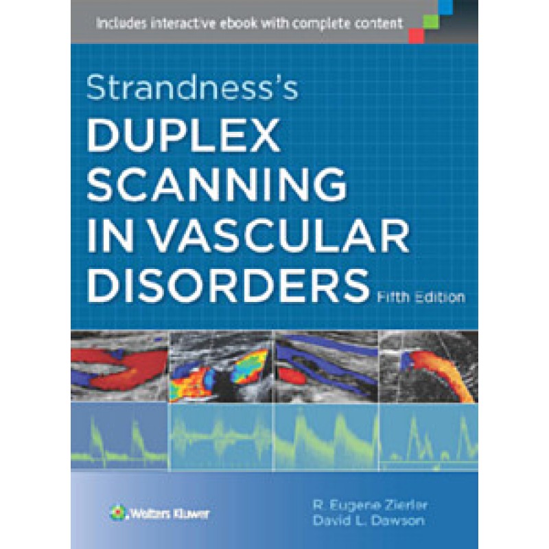 Strandness's Duplex Scanning in Vascular Disorders, 5e