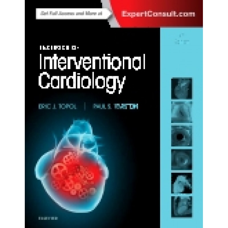 Topol, Textbook of Interventional Cardiology, 7th Edition