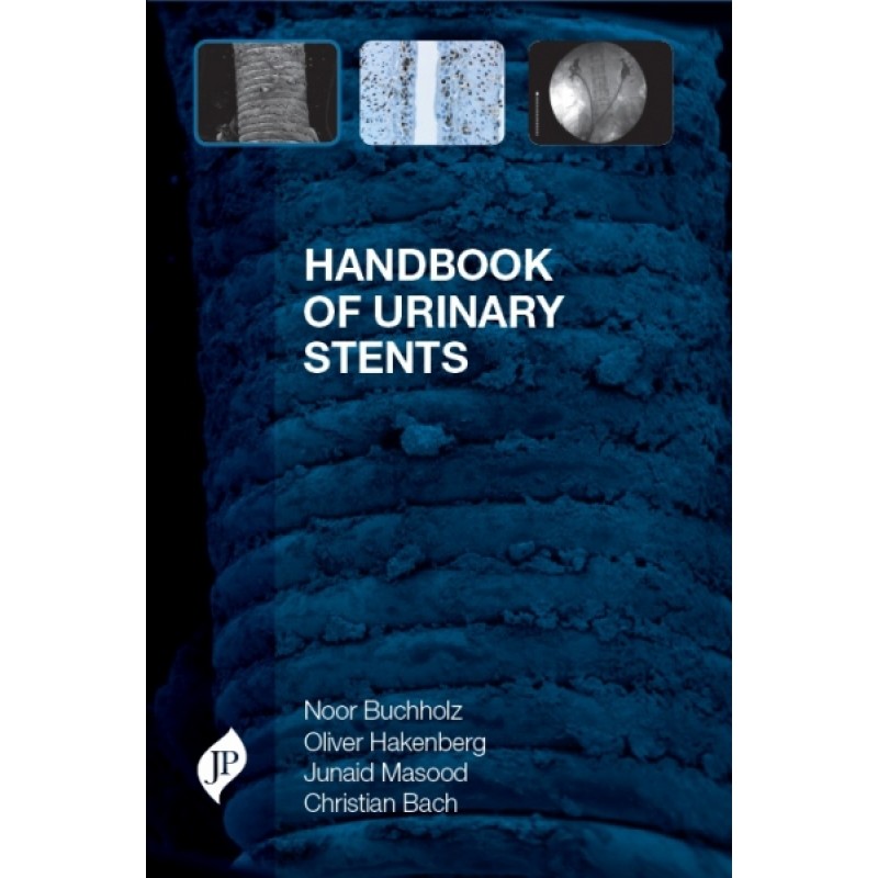 Handbook of Urinary Stents
