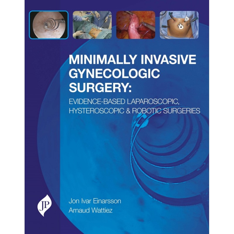 Minimally Invasive Gynecologic Surgery: Evidence-Based Laparoscopic, Hysteroscopic and Robotic Surgeries