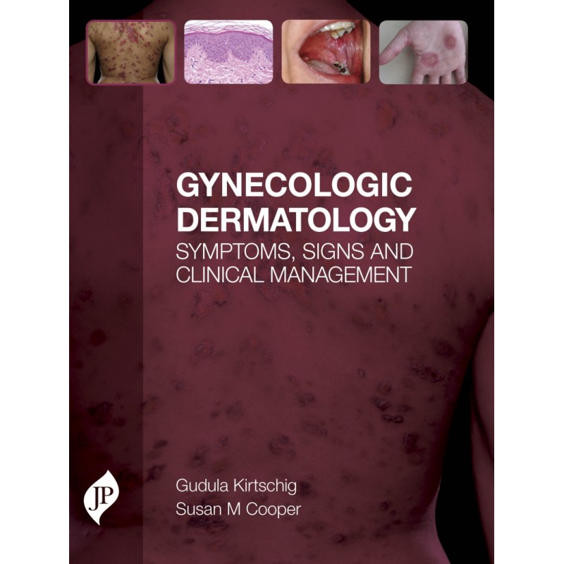 Gynecologic Dermatology: Symptoms, Signs and Clinical Management