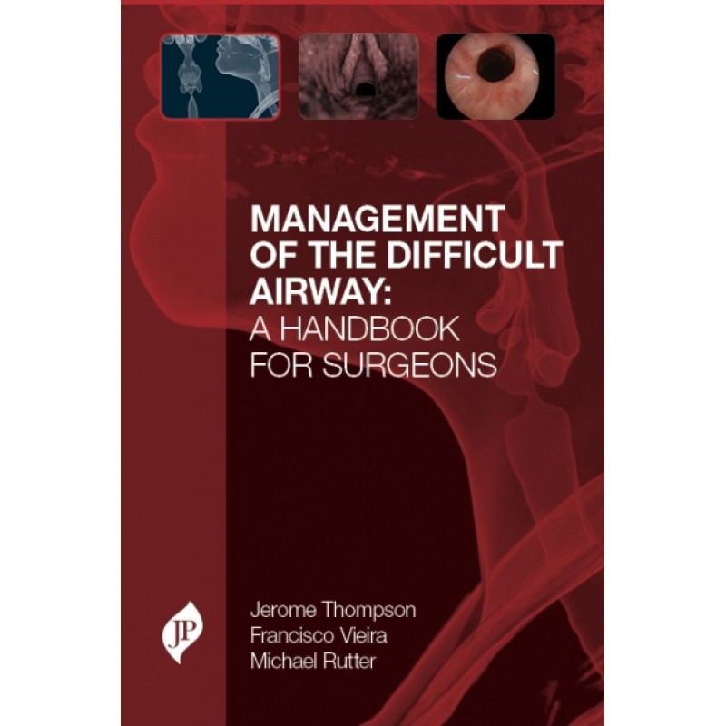 Management of the Difficult Airway: A Handbook for Surgeons