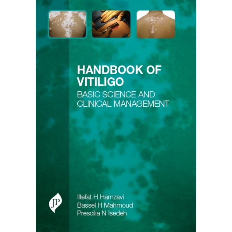 Handbook of Vitiligo