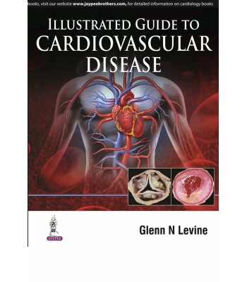 Illustrated Guide to Cardiovascular Disease