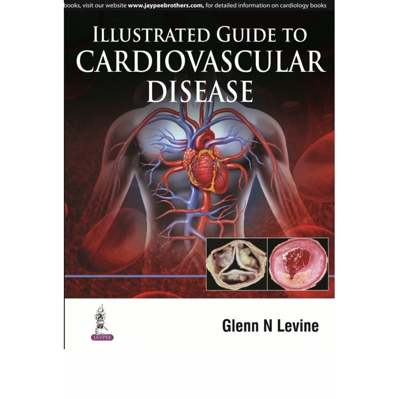 Illustrated Guide to Cardiovascular Disease