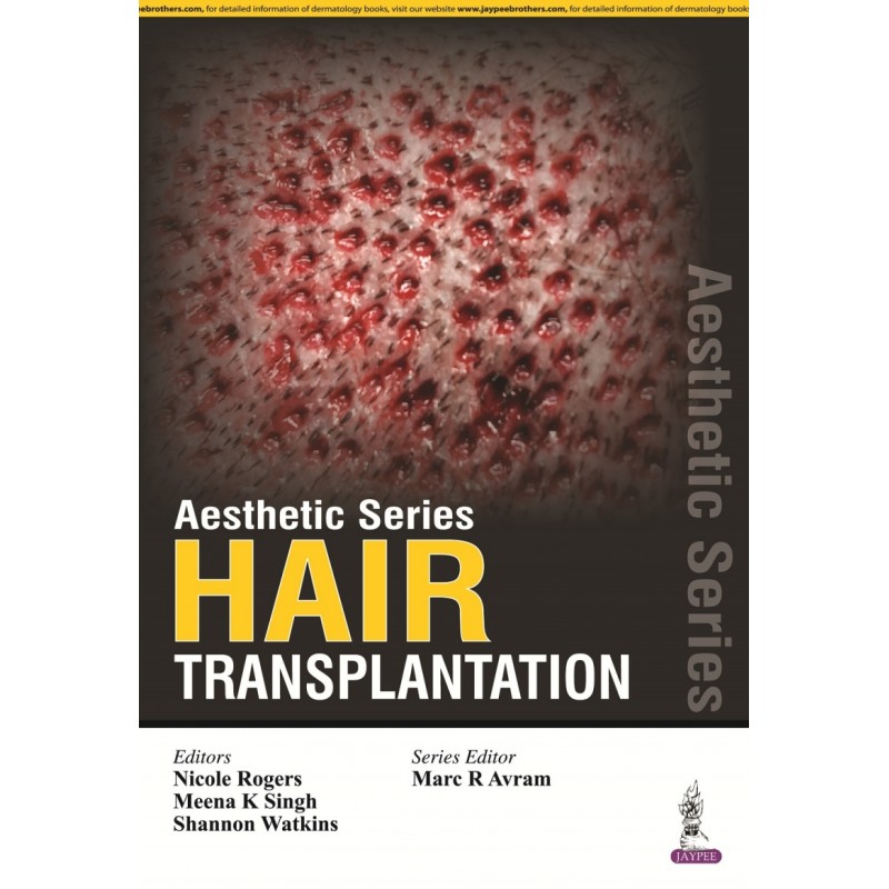 Aesthetic Series - Hair Transplantation