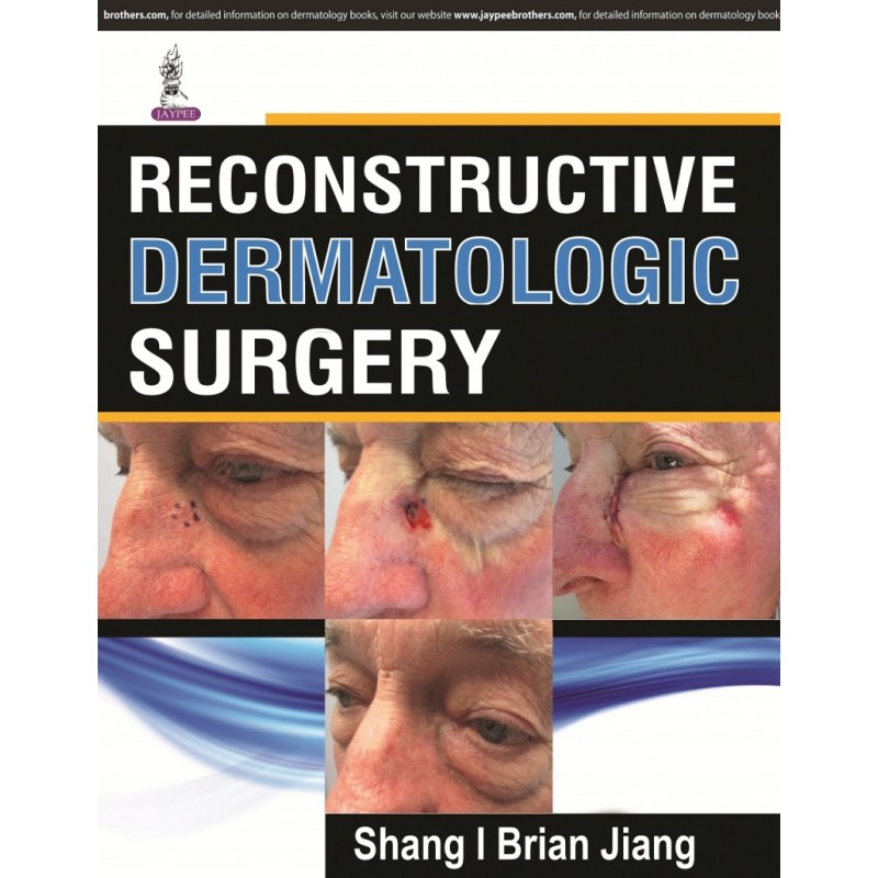 Reconstructive Dermatologic Surgery