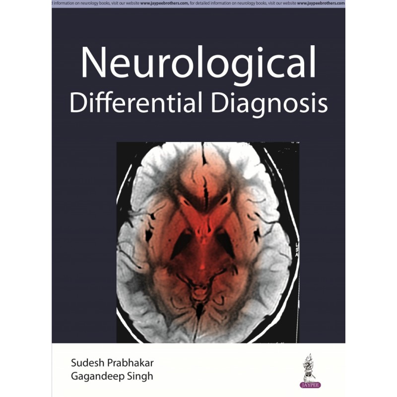 Neurological Differential Diagnosis