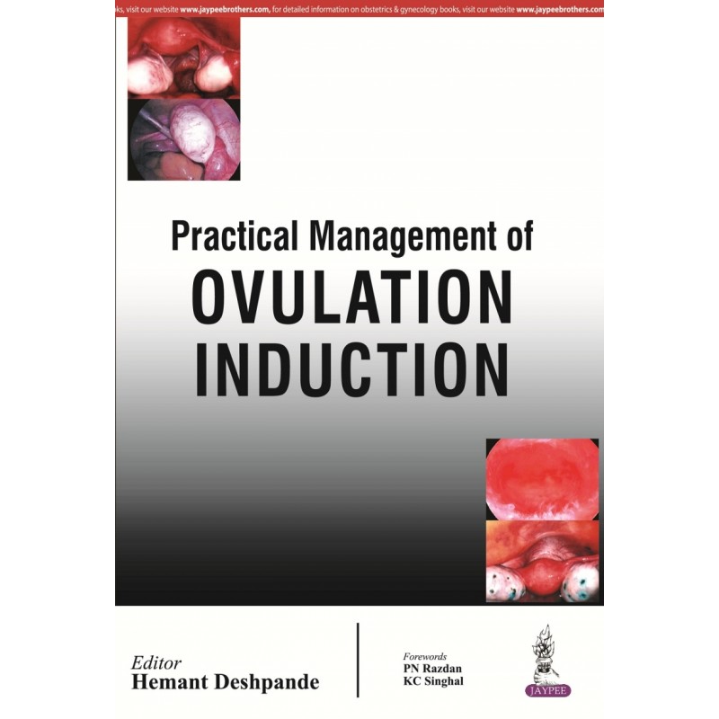 Practical Management of Ovulation Induction