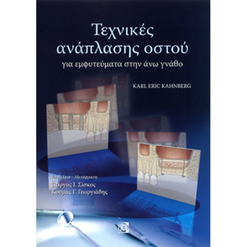 Τεχνικές Ανάπλασης Οστού για Εμφυτεύγματα στην Άνω Γνάθο