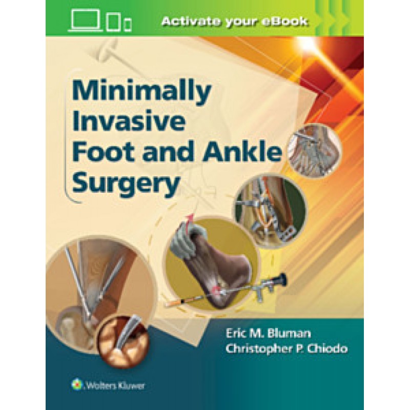 Minimally Invasive Foot  and Ankle Surgery