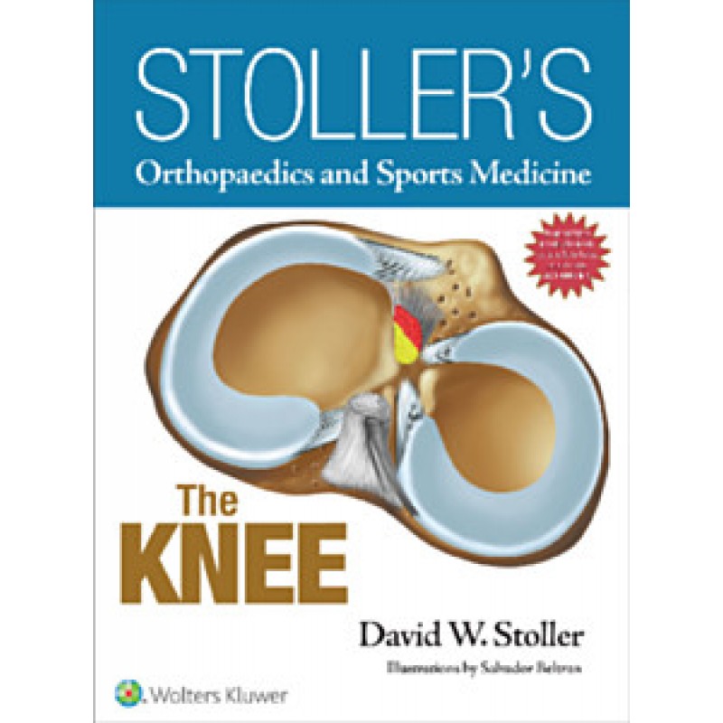 Stoller's Orthopaedics and Sports Medicine: The Knee Package PRINT EDITION PACKAGED WITH STOLLER LECTURE VIDEOS AND STOLLER NOTES