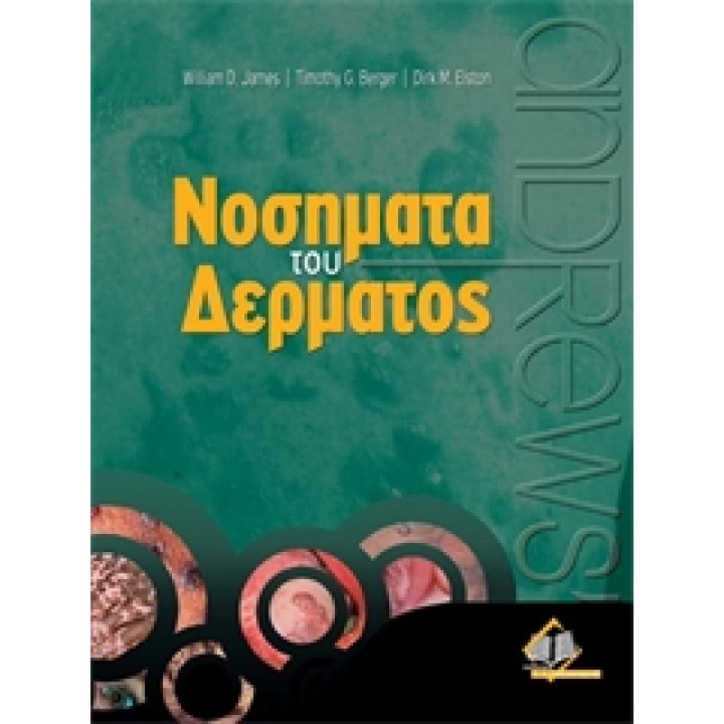Νοσήματα του Δέρματος, James ( ΕΞΑΝΤΛΗΜΕΝΟ)