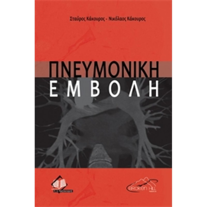 Πνευμονική Εμβολή
