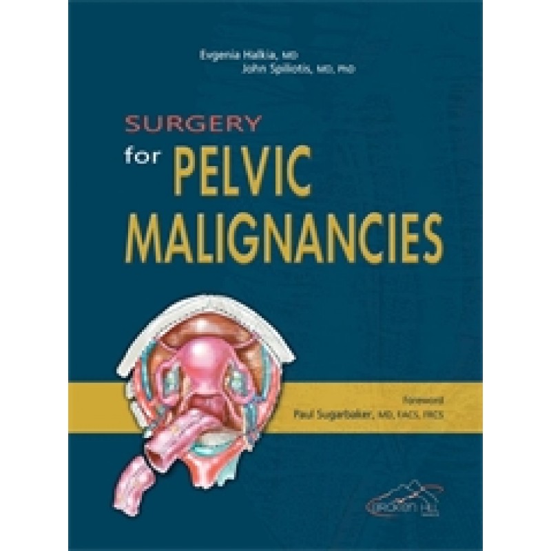 Surgery for Pelvic Malignancies