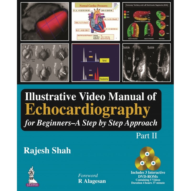 Illustrative Video Manual of Echocardiography for Beginners: A Step by Step Approach (Part II)