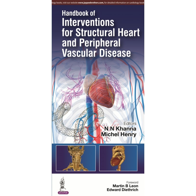 Handbook of Interventions for Structural Heart and Peripheral Vascular Disease