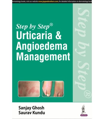 Step by Step: Urticaria &amp; Angioedema Management