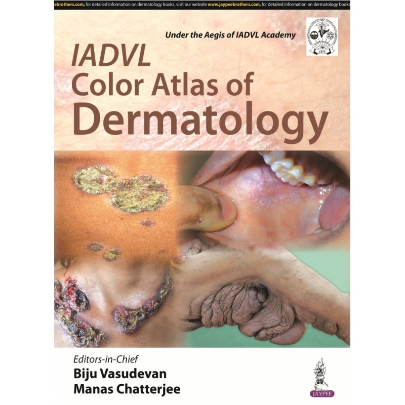 IADVL Color Atlas of Dermatology