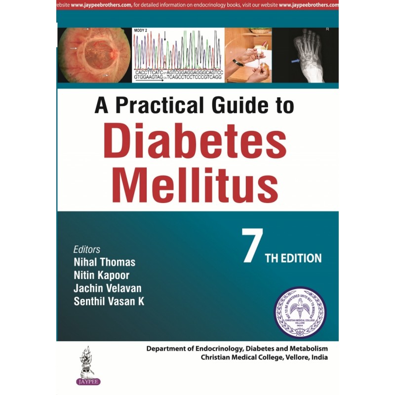 A Practical Guide to Diabetes Mellitus