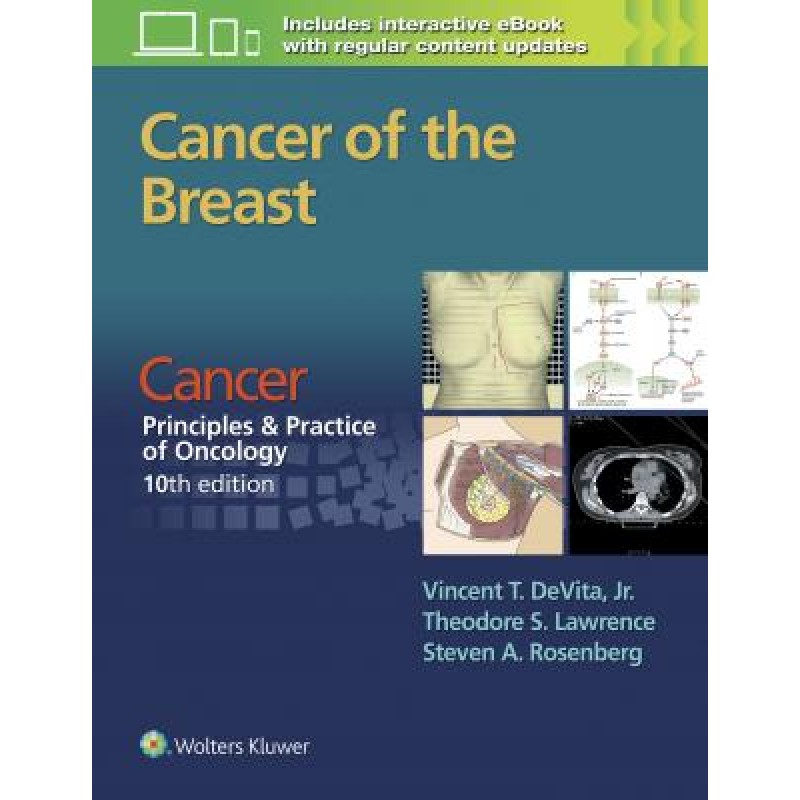 Cancer of the Breast FROM CANCER: PRINCIPLES  and PRACTICE OF ONCOLOGY, 10TH EDITION