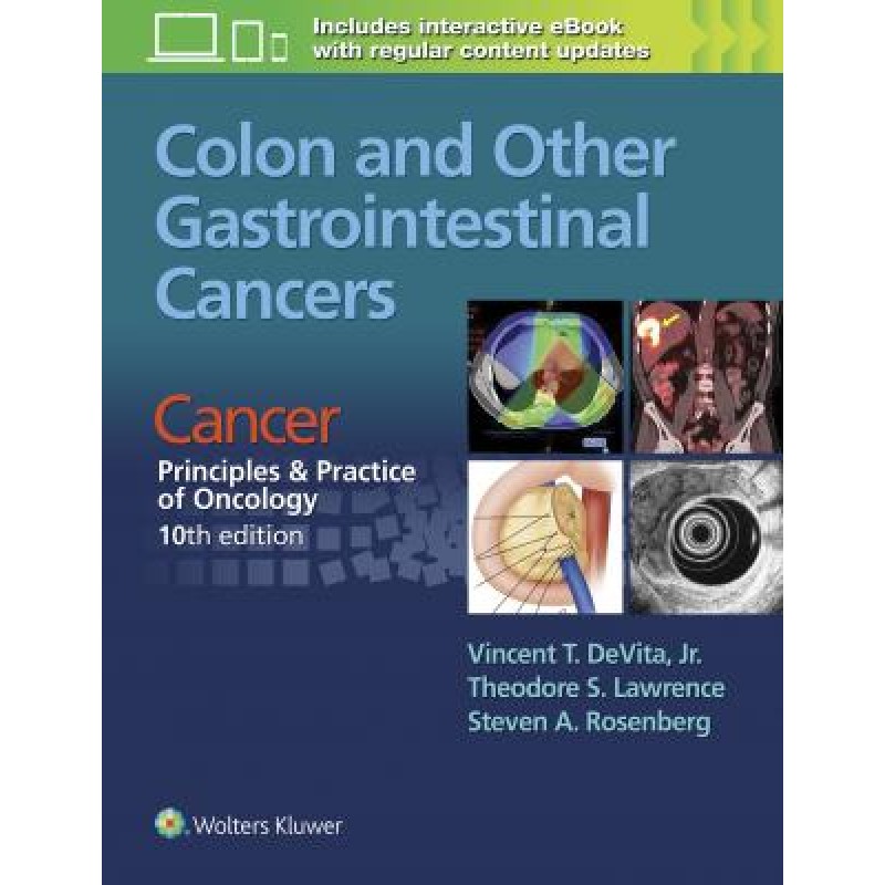 Colon and Other Gastrointestinal Cancers Cancer: Principles  and Practice of Oncology, 10th edition