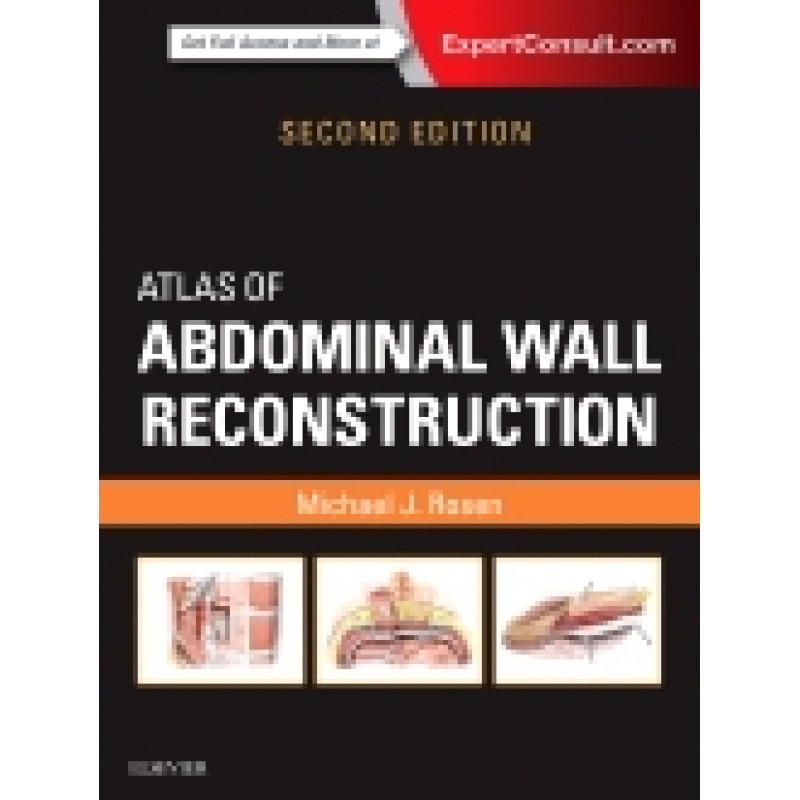 Atlas of Abdominal Wall Reconstruction, 2nd Edition
