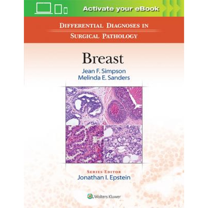 Differential Diagnoses in Surgical Pathology: Breast