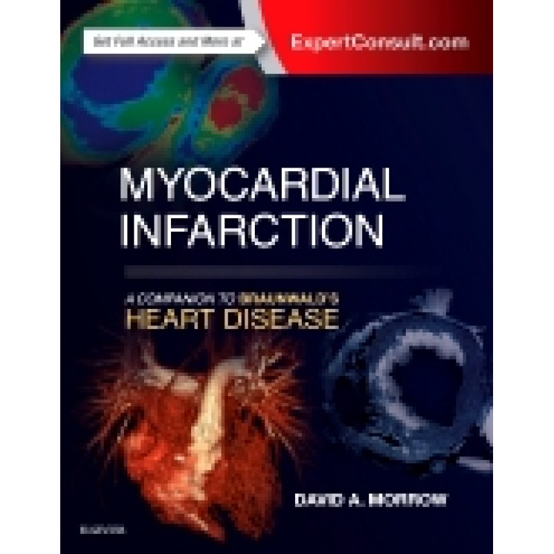 Myocardial Infarction: A Companion to Braunwald's Heart Disease