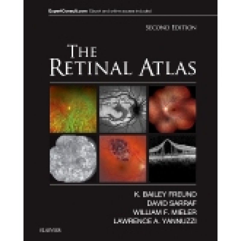 The Retinal Atlas, 2nd Edition