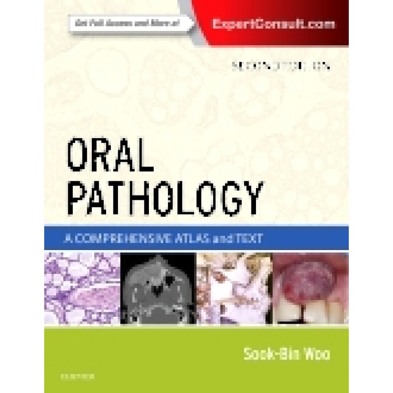 Oral Pathology, 2nd Edition