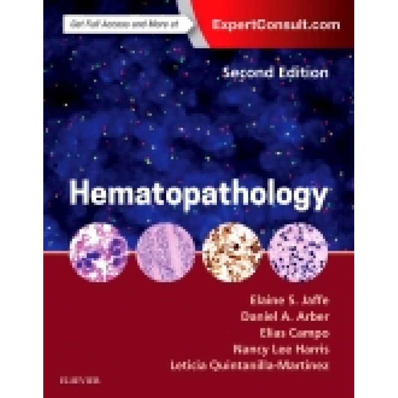 Hematopathology, 2nd Edition