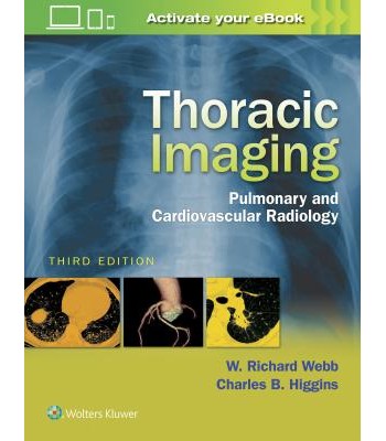 Thoracic Imaging, 3e PULMONARY AND CARDIOVASCULAR RADIOLOGY