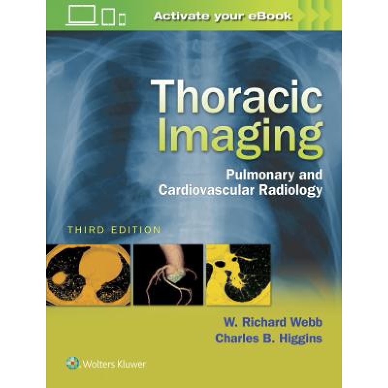 Thoracic Imaging, 3e PULMONARY AND CARDIOVASCULAR RADIOLOGY