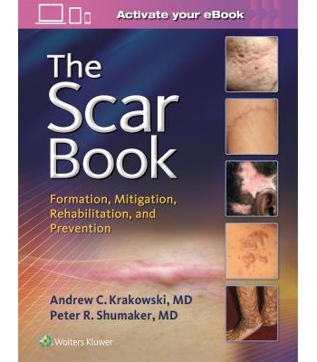 The Scar Book FORMATION, MITIGATION, REHABILITATION AND PREVENTION