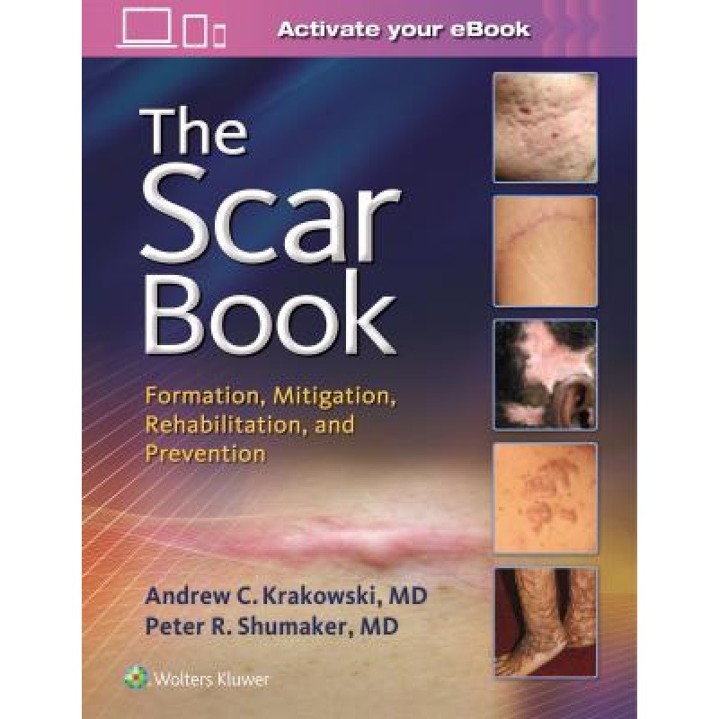 The Scar Book FORMATION, MITIGATION, REHABILITATION AND PREVENTION