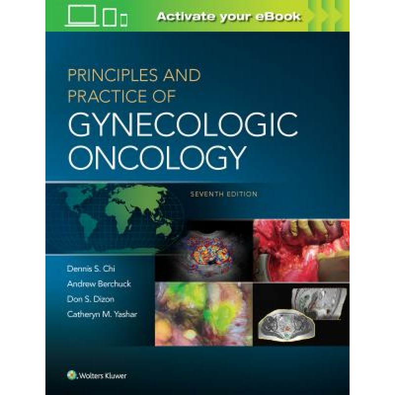 Principles and Practice of Gynecologic Oncology, 7e