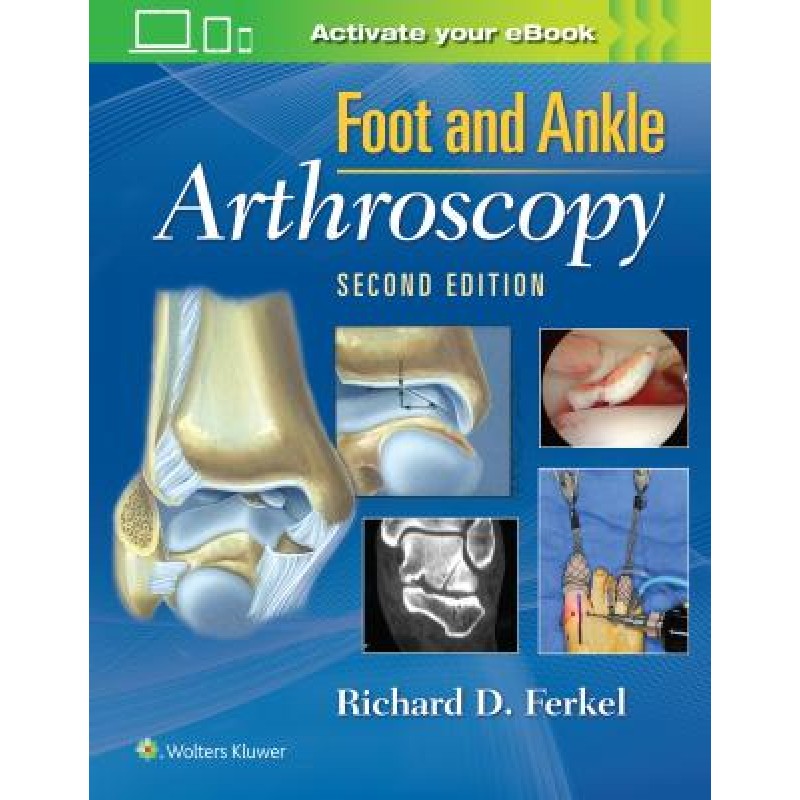 Foot &amp; Ankle Arthroscopy, 2e