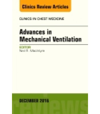 Advances in Mechanical Ventilation, An Issue of Clinics in Chest Medicine, Volume 37-4