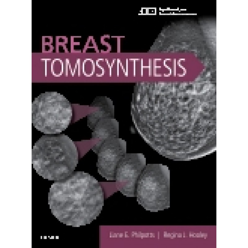 Breast Tomosynthesis
