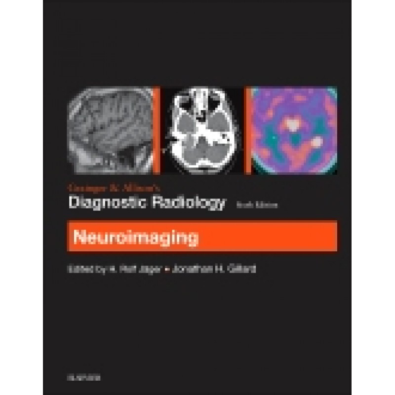 Grainger  and Allison’s Diagnostic Radiology: Neuroimaging, 6th Edition