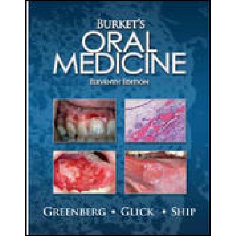 Burket's Oral Medicine