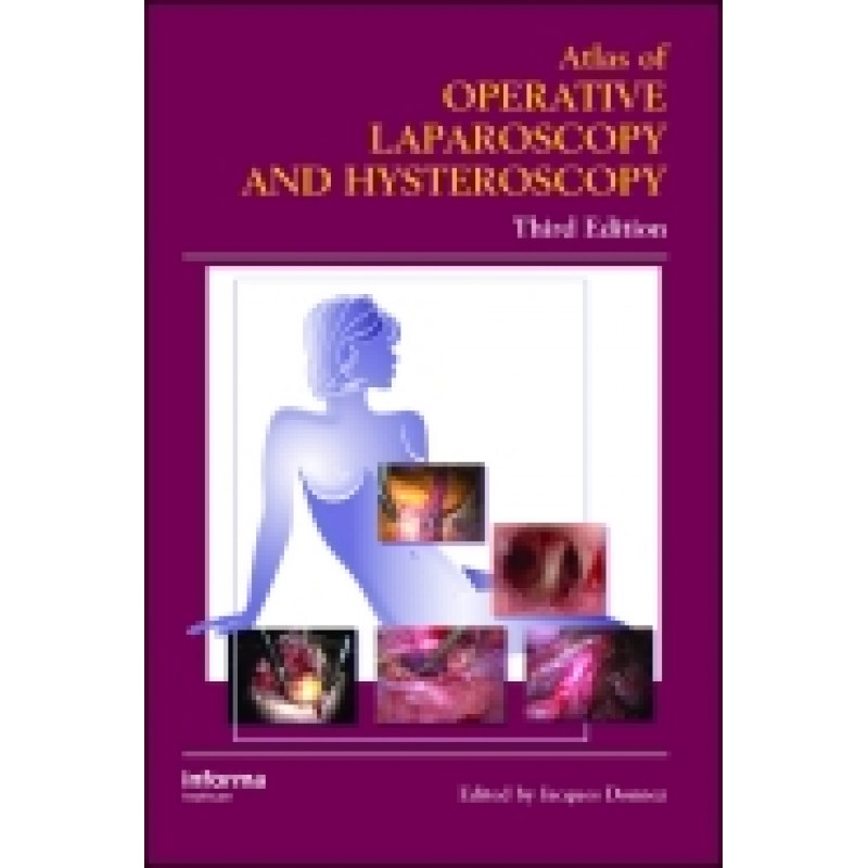 Atlas of Operative Laparoscopy and Hysteroscopy, Third Edition Series: Encyclopedia of Visual Medicine
