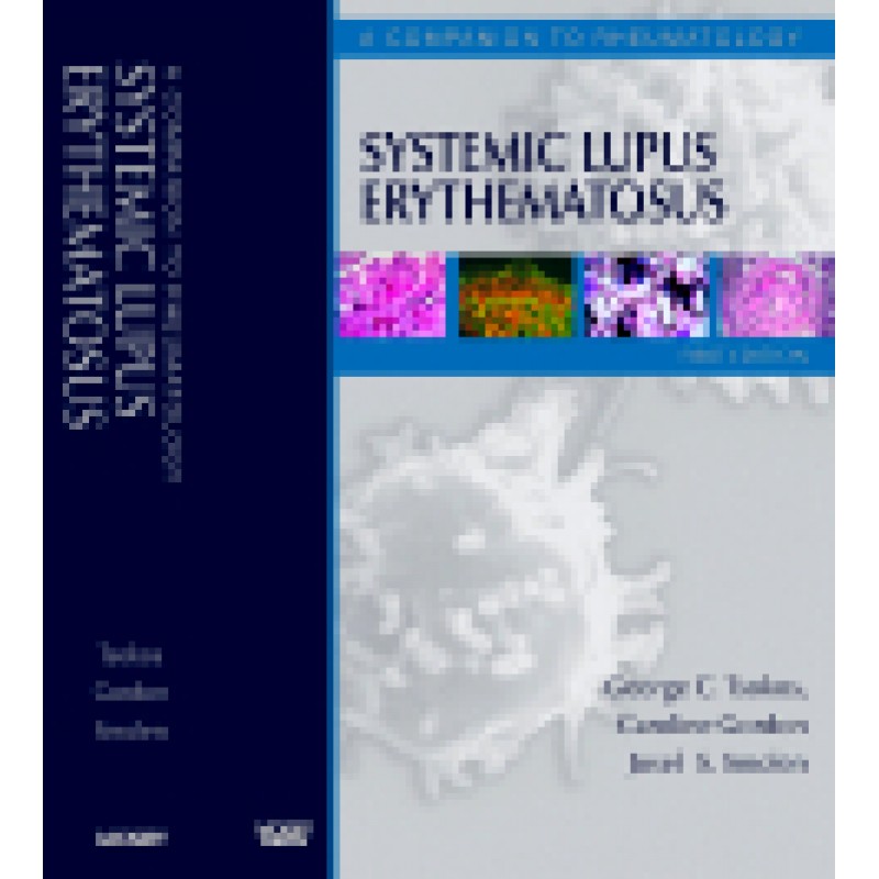 Systemic Lupus Erythematosus A Companion to Rheumatology