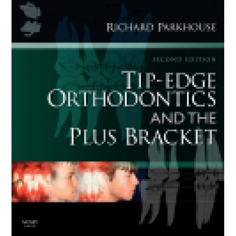 Tip-Edge Orthodontics and the Plus Bracket, 2nd Edition