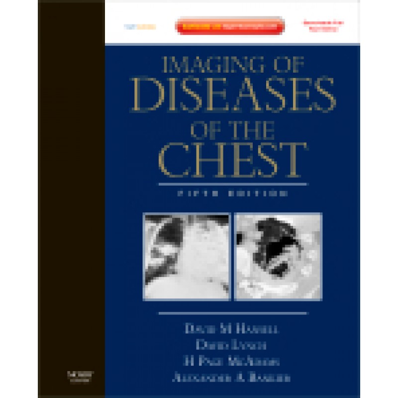 Imaging of Diseases of the Chest, 5th Edition Expert Consult - Online and Print