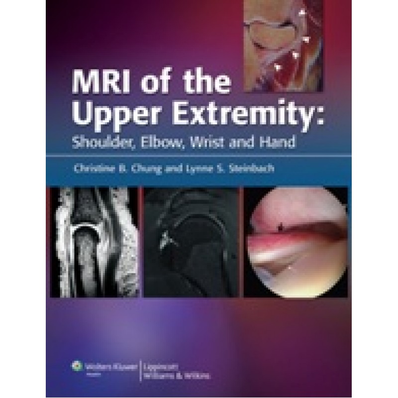 MRI of the Upper Extremity : Shoulder, Elbow, Wrist, and Hand