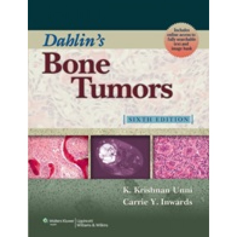 Dahlin's Bone Tumors 6/e (General Aspects and Data on 11,087 Cases )