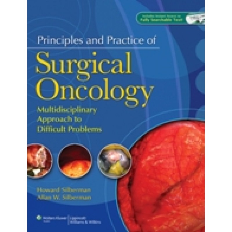 Principles and Practice of Surgical Oncology